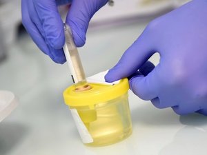 Cadmium : le test de dépistage des patients à risque coûtera 27,50 euros et sera remboursé à 60 % par l’Assurance maladie