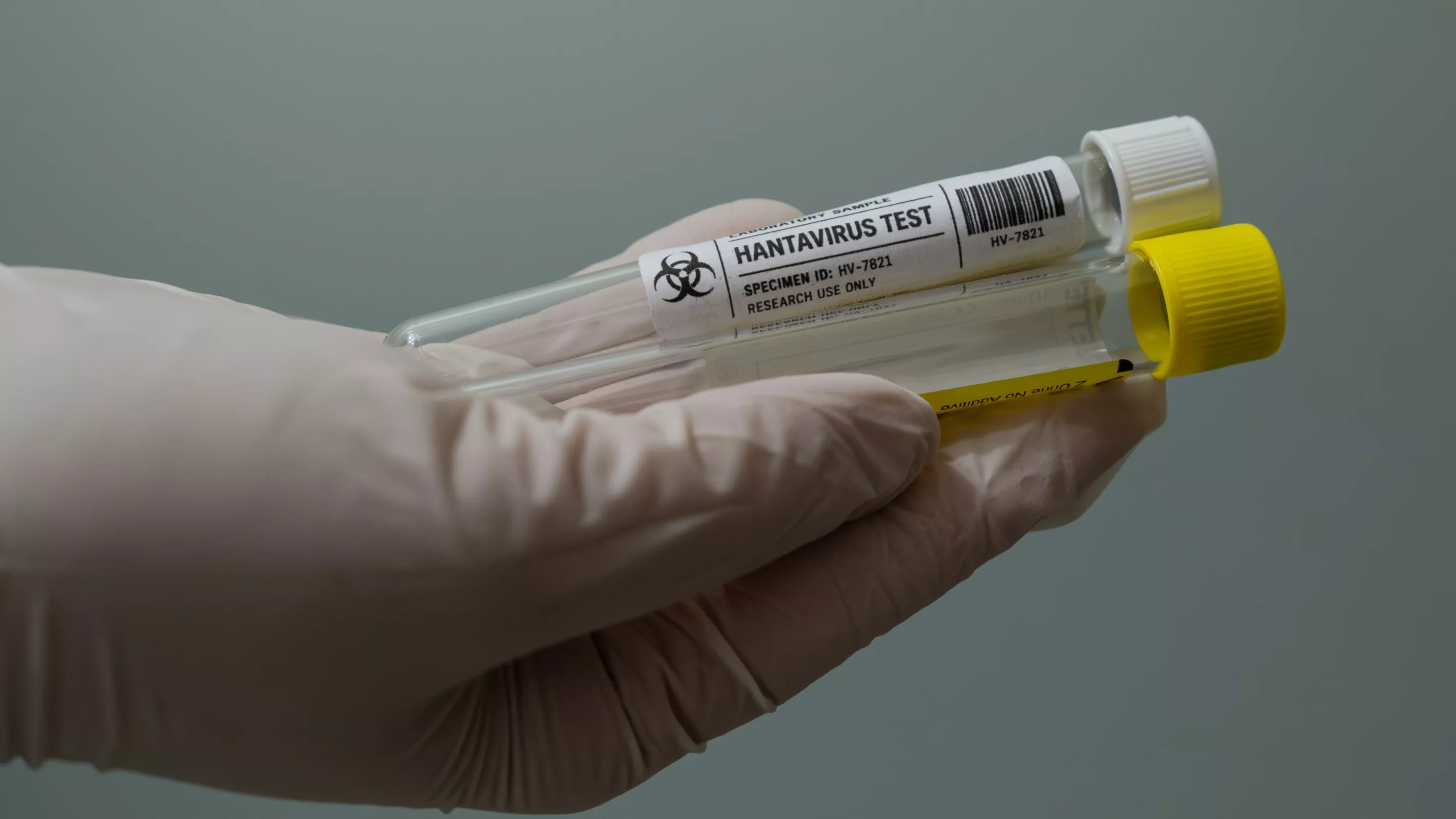 Hantavirus : un touriste ayant transité en France testé positif