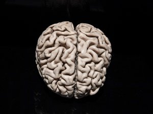 Journée mondiale d’Alzheimer : un simple test sanguin mis au point à Montpellier bouleverse le dépistage mais la France refuse toujours le nouveau traitement